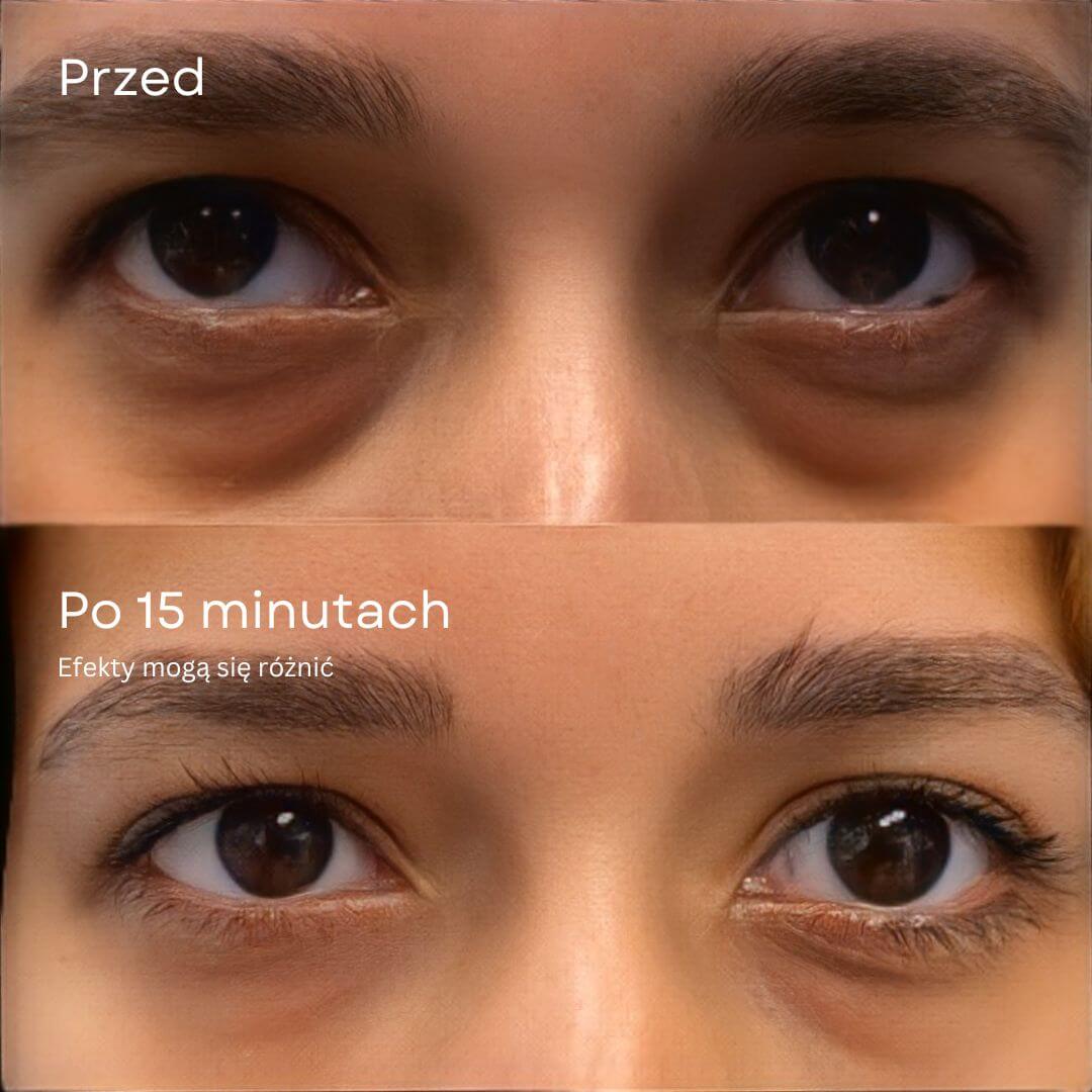 24K Gold Eye Mask dla wypoczętego i przebudzonego spojrzenia