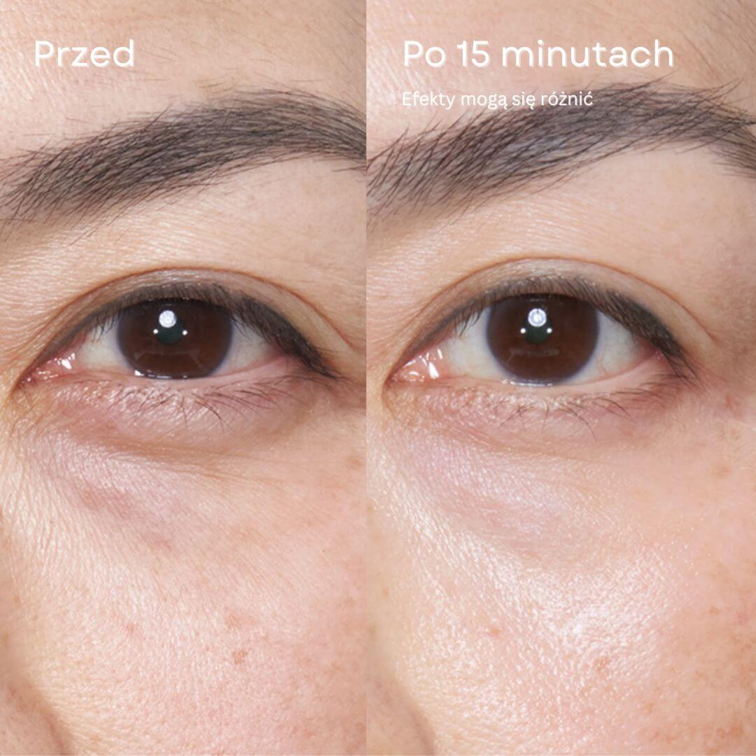 24K Gold Eye Mask dla wypoczętego i przebudzonego spojrzenia
