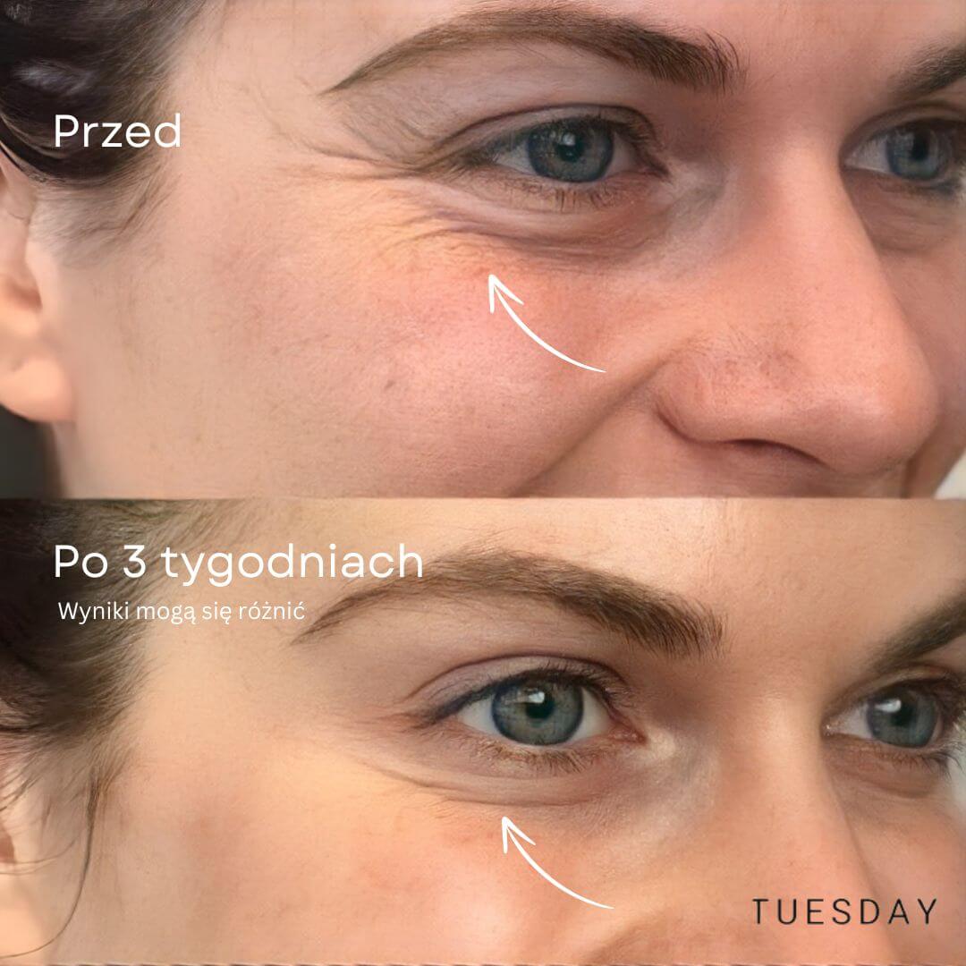 Serum przeciwstarzeniowe z 24-karatowym złotem