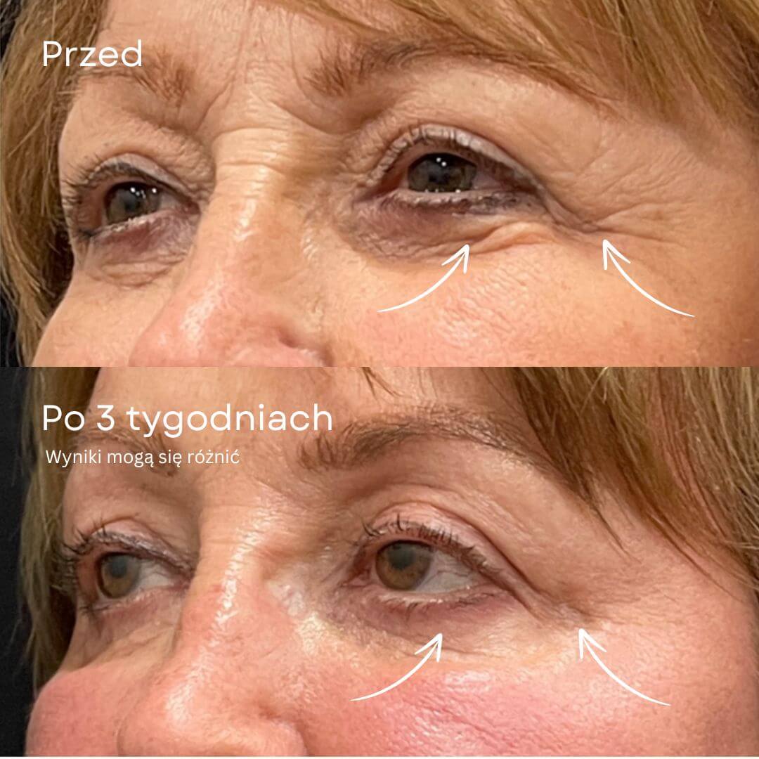 Retinolowy sztyft pod oczy GlowLift