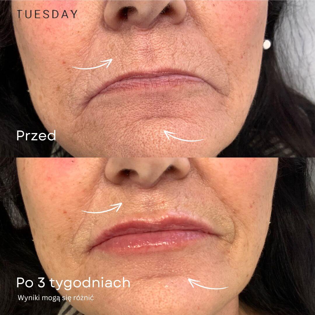 Serum przeciwstarzeniowe z 24-karatowym złotem