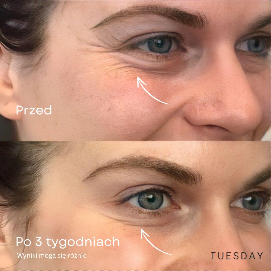 Retinolowy sztyft pod oczy GlowLift